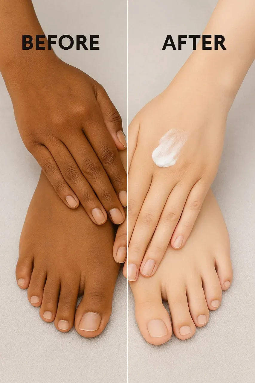 Hand & Feet Whitening Cream - 🔥 Free Shipping 🚚 - Cosmic Herbs