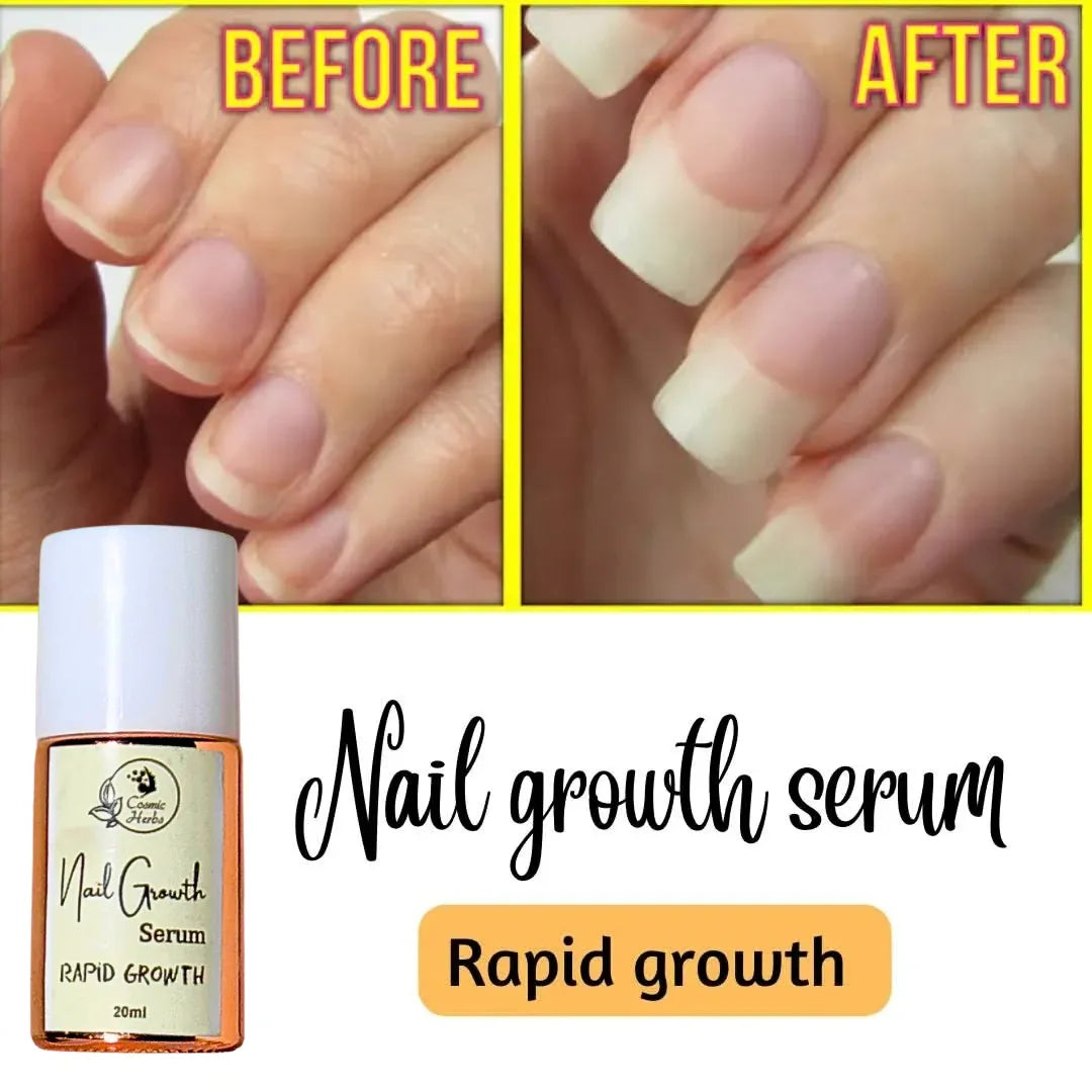 Nail Growth Serum(Rapid Growth)🔥 Free Shipping 🚚 - Cosmic Herbs